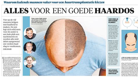 Waarom Kiezen Voor Haartransplantatie?